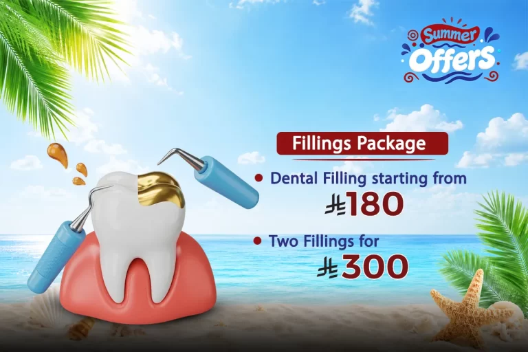 Fillings Package