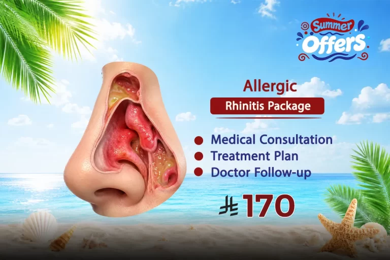 Allergic Rhinitis Package