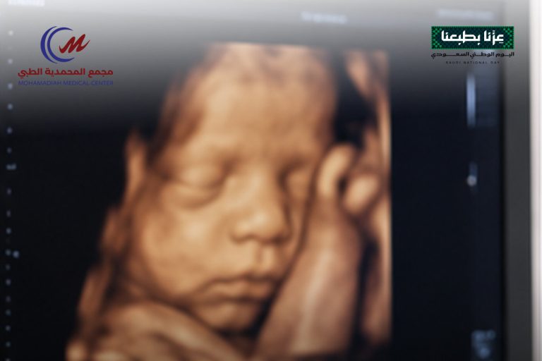 سونار 4D للحمل تعرفي على مميزاته ومتى تحتاجين إليه