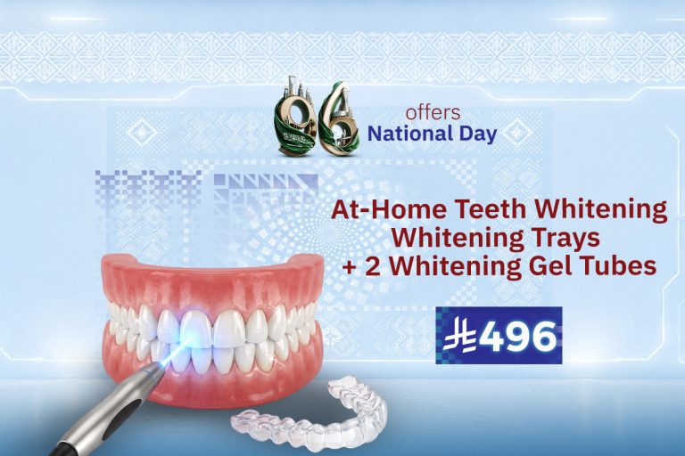 At-Home Teeth Whitening