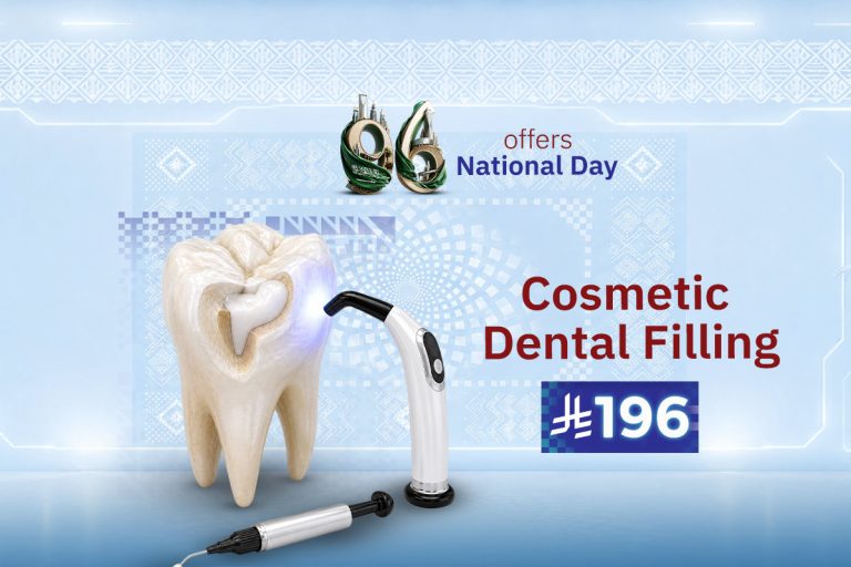 Cosmetic Dental Fillings
