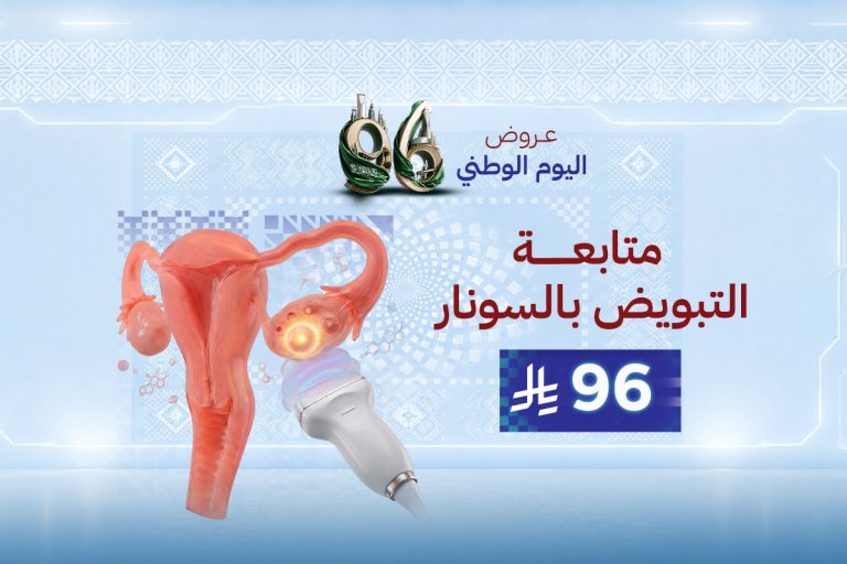 متابعة التبويض بالسونار