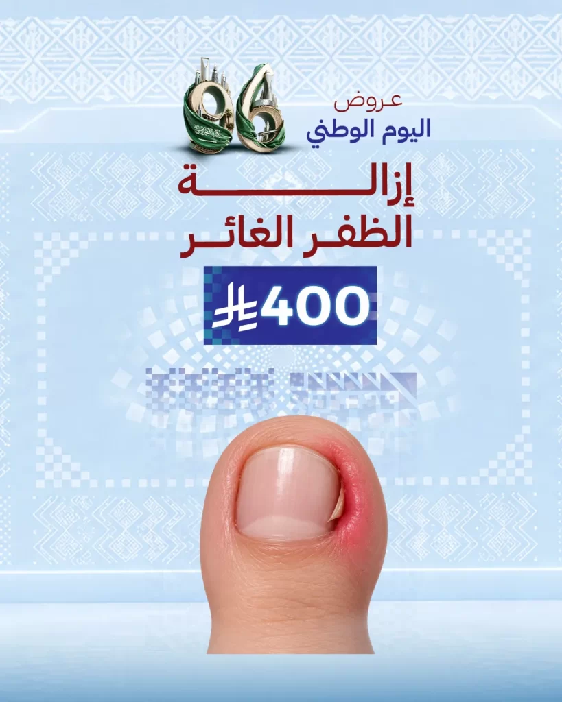 إزالة الظفر الغائر