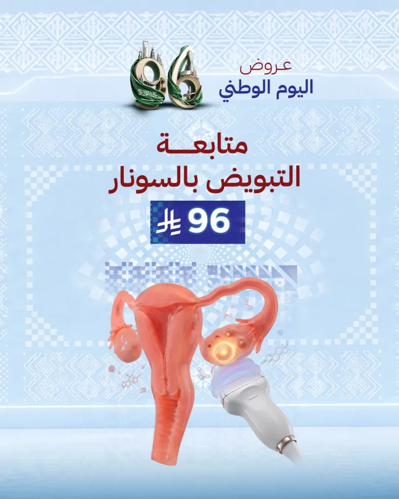 متابعة التبويض بالسونار