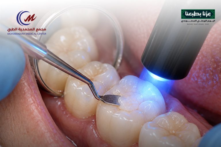 الحشوات التجميلية للأسنان : استخداماتها ومميزاتها